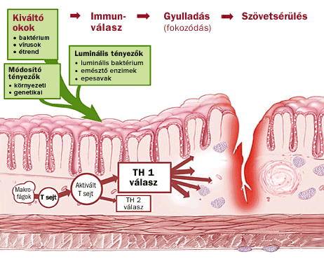 Crohn betegsg